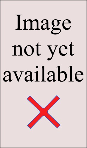 Blindness in Part cover image